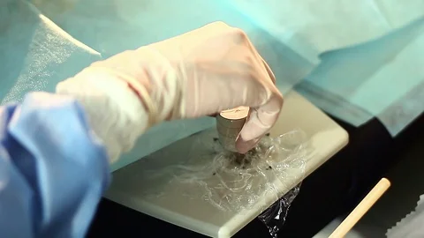 Laparoscopic surgery Stock-Footage 98211218