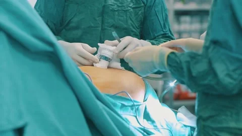 Laparoscopic Surgery Stock Footage 144559933