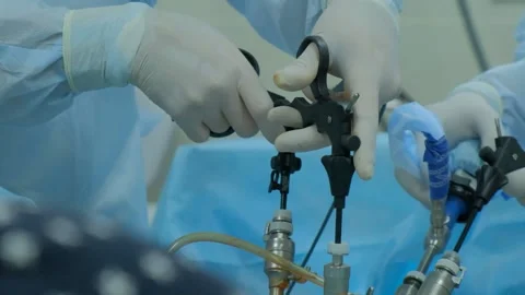 Laparoscopic tool of cholecystectomy use... | Stock Video | Pond5