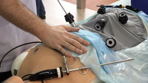 Laparoscopy Stock Footage 88200963