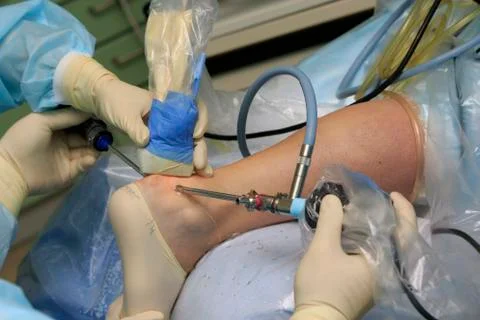 Laparoscopy Foto stock