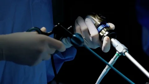 Laparoscopy surgical operation surgeons using Endoscopy and Laparoscope Stock Footage
