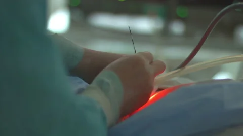 Laporoscopic surgery, close up Stock Footage 64423805