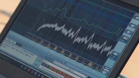 Laptop with lie detector diagram (polygraph). Reports testimony from a Stock Footage 137343089