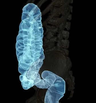 Large bowel or colon Stock Illustration