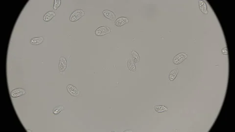 A large colony of dead protozoa under a microscope Stock Footage 88188766