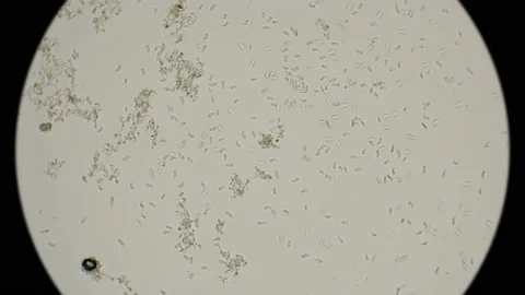 A large colony of protozoa moves under a microscope Stock Footage 88166482