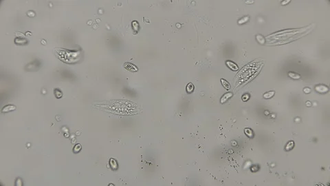 A large colony of various protozoa under a microscope Stock Footage 92794931