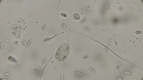 A large colony of various protozoa under a microscope Stock Footage 92795133