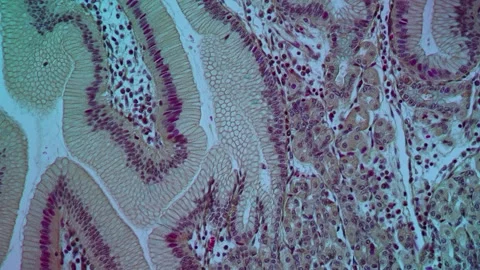 Large intestine with diverticular tissue 스톡 동영상 343126433