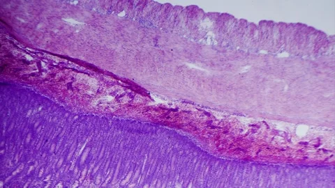 Large intestine transverse section Vídeos de archivo 291960088