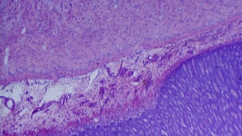 Large intestine transverse section 库存影片 291963438