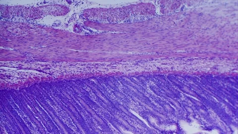 Large intestine transverse section 库存影片 291963721