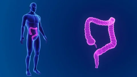 Large intestine zoom with body Stockbeeldmateriaal 74471804