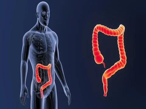 Large Intestine zoom with Skeleton 스톡 동영상 84975440