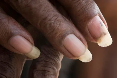 Large Nails Stock Photos