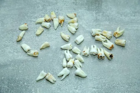 A large number of diseased teeth Stock Photos