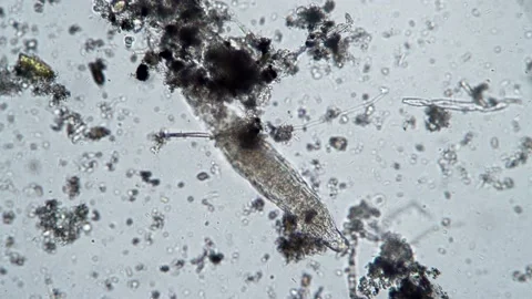 A large rotifer moves in water under a microscope Stock Footage 141546304