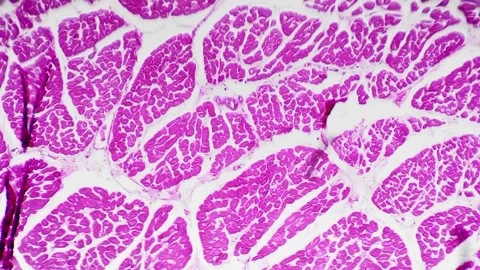 Large vein pattern in section filmed und... | Stock Video | Pond5