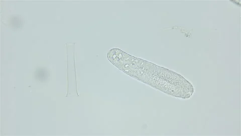 Larva Cnidaria under a microscope, possibly order Siphonophora. Red sea Stock Footage 235902127