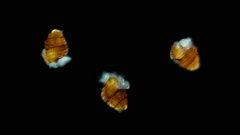 A larva of a sea snail under a microscope, called veliger, class Gastropoda Stock Footage 121913999