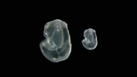 The larva of the starfish Asteroidea, under the microscope, is in the early Stock Footage 126095800