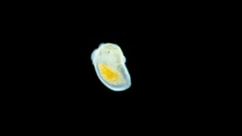 Larva under a microscope, possibly a Platyhelminthes worm Stock Footage 258644736