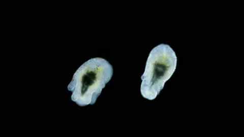 Larva of worm Polycladida under microscope, class Turbellaria. Muller larva in Stock Footage 167118879