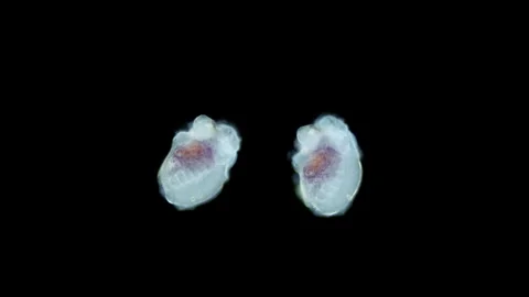 Larva worm Polynoidae under microscope, stage metatrochophore. Stock Footage 249997517