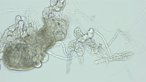 Larvae of parasitic worm Progonus muelleri under a microscope, Cercaria Vidéo 252755862