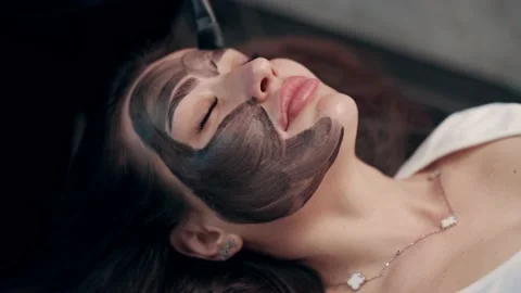 Laser carbon peeling of face 스톡 동영상 237885520