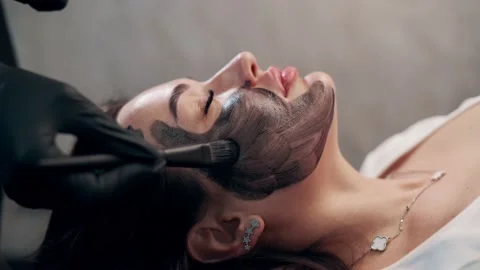 Laser carbon peeling of face Video stock 238714614