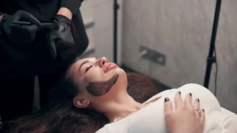 Laser carbon peeling of face 스톡 동영상 239289853