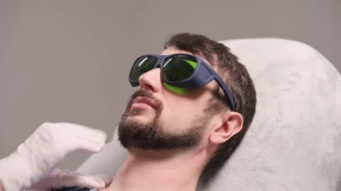 Laser depilation of beard contour. Stock Footage 171336508
