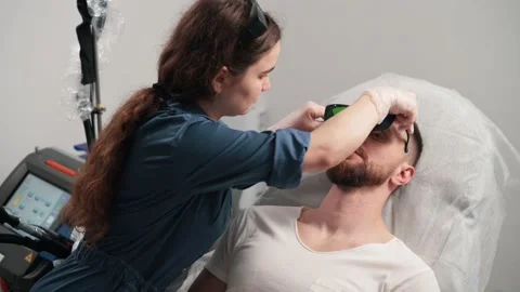 Laser depilation of beard contour. Stock Footage 196807987