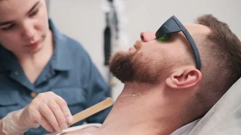 Laser depilation of beard contour. Stock Footage 198220524