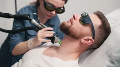 Laser depilation of beard contour. Stock Footage 201949417