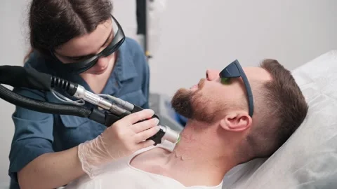Laser depilation of beard contour. Stock Footage 205601867