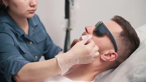 Laser depilation of beard contour. Stock Footage 224716114