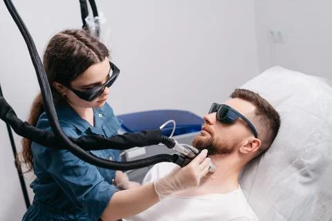 Laser depilation of beard contour. Stock Photos