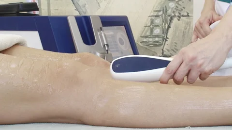 Laser depilation Stock Footage 47476031