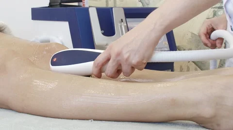 Laser depilation Stock Footage 47476099