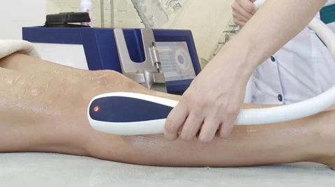 Laser depilation Stock Footage 47476140