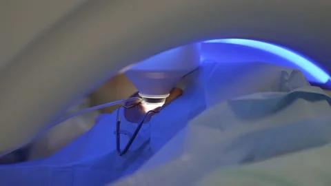 Laser eye correction using SMILE method. Laser moves up from eye. Stock Footage 159469180