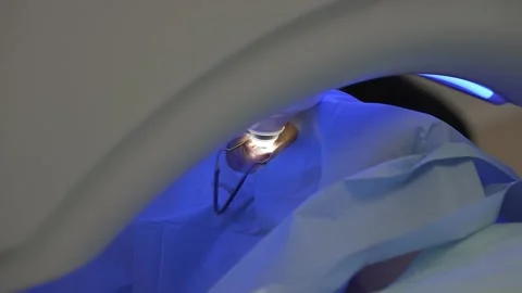 Laser eye correction using SMILE method. Laser moves down to patient eye. Video stock 162631585