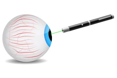 Laser on eye Stock Illustration