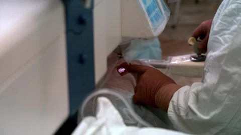 Laser eye surgery. Close-up eye surgery. Video stock 147091810