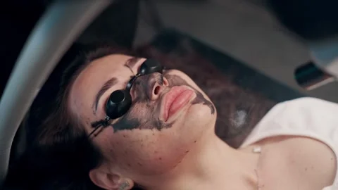 Laser face peel. Stock Footage 241612044