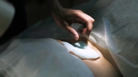 Laser Operator removes Tattoos from Leg - Tattoo Removal Vídeos de archivo 76043648