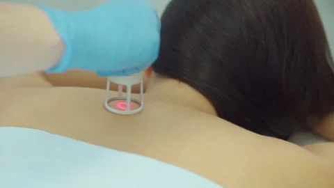 Laser physiotherapy applied to patient back during rehabilitation Stock Footage 325854732